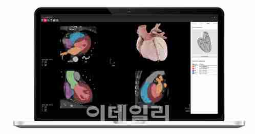 에이아이메딕 한국벤처투자에서 주관하는 ‘K-유니콘 라이징스타’에 선정