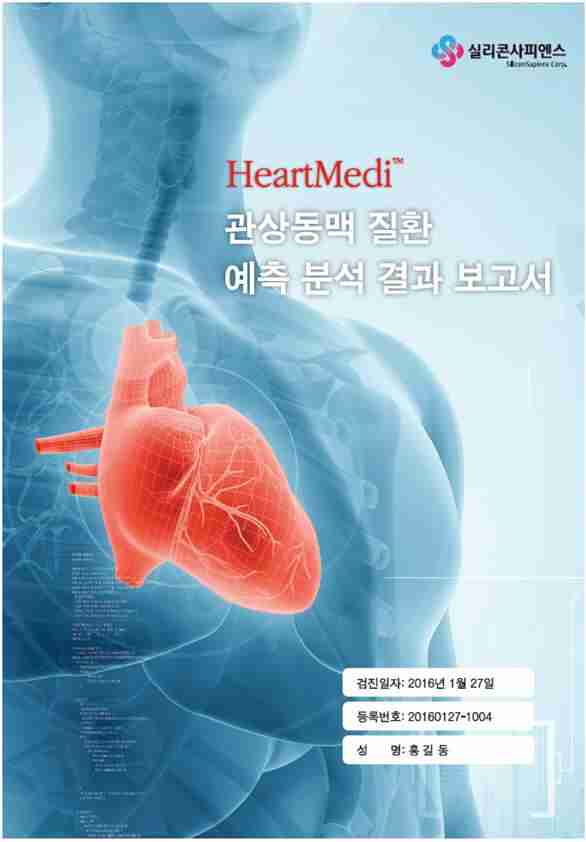 약물투입, 와이어 삽입 없이 관상동맥 질환 예측